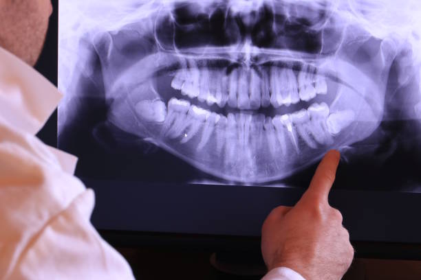 Best Emergency Treatment for Oral Infections in Fairmount, CO