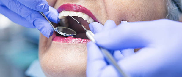 Best Emergency Dental Care for Sports Injuries in Fairmount, CO